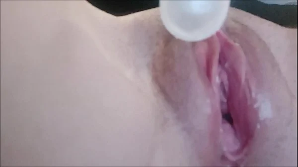 the gynecologist has no secrets for my broken holes